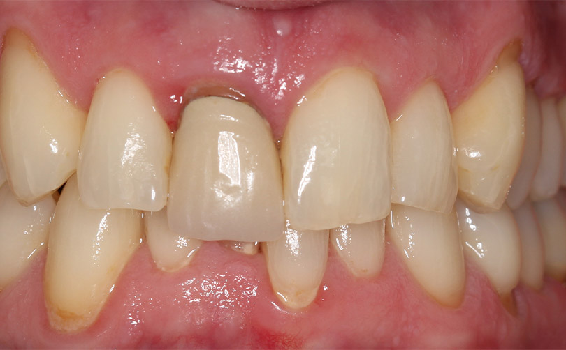 Before - Aventis dental