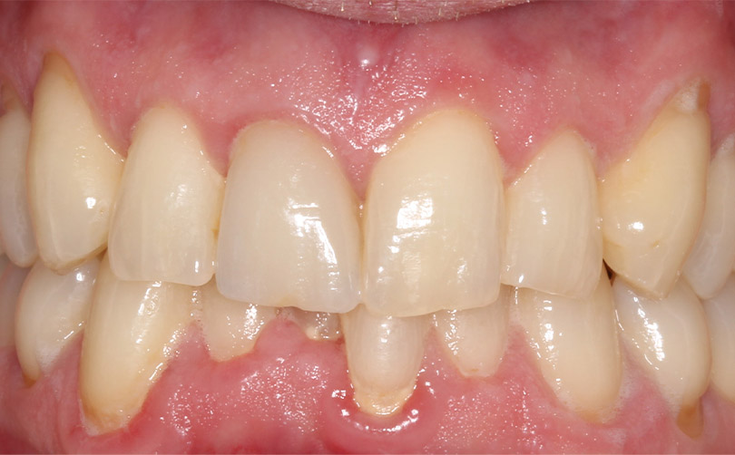 After - Aventis dental