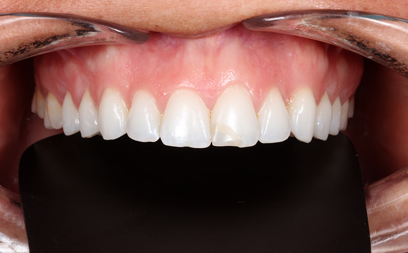 Before - Aventis dental