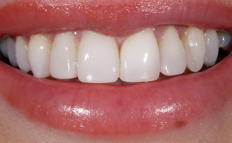 After - Aventis dental