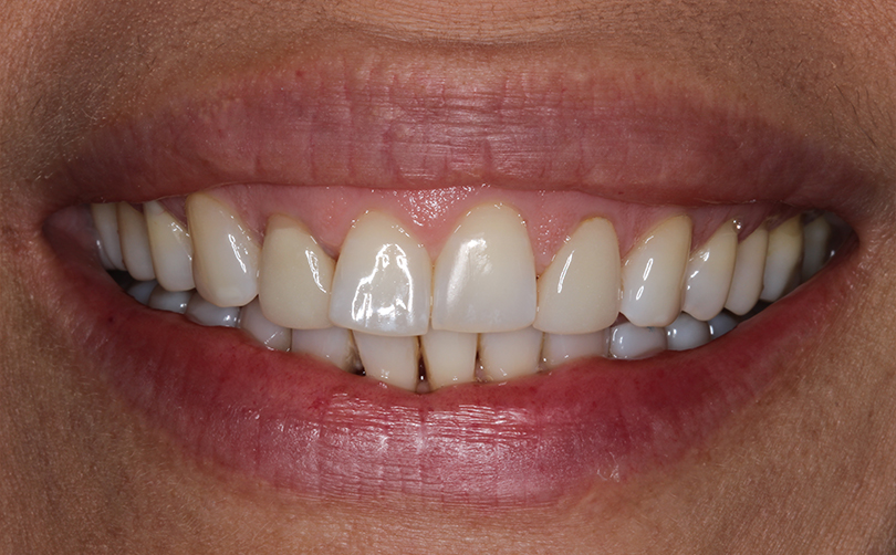 Aventis Dental & Facial Aesthetics - Case 5 2024 B (2) Before - Aventis dental