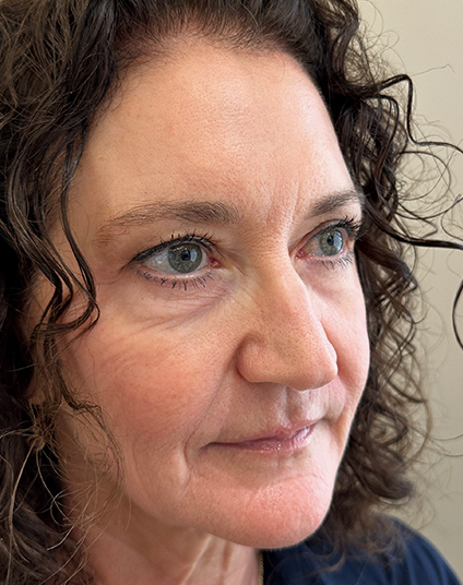 After - Aventis dental