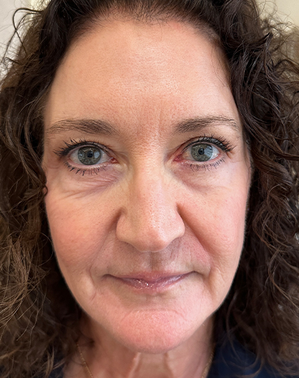 Before - Aventis dental