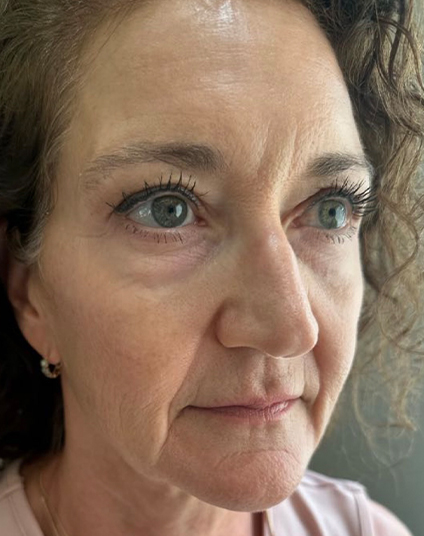 Before - Aventis dental