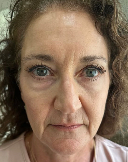 After - Aventis dental