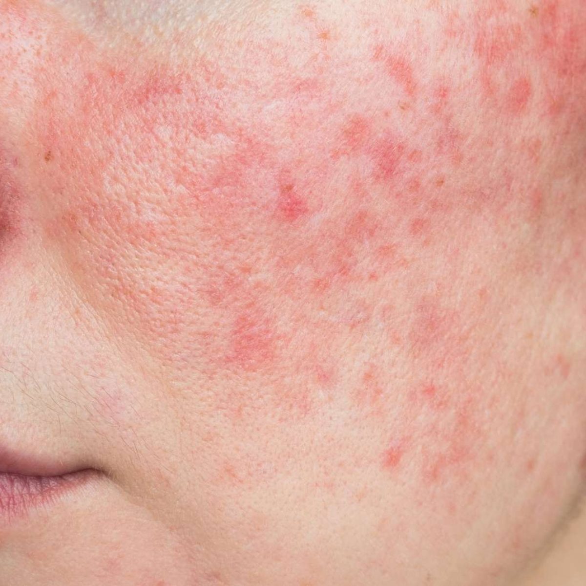 Treatment - Aventis Dental