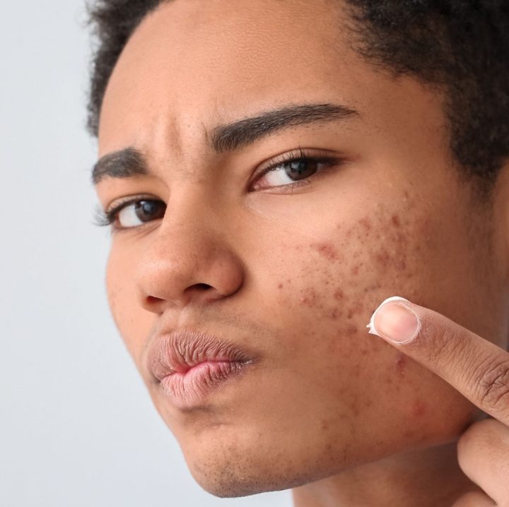 Treatment - Aventis Dental