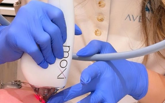 Blog - Aventis Dental