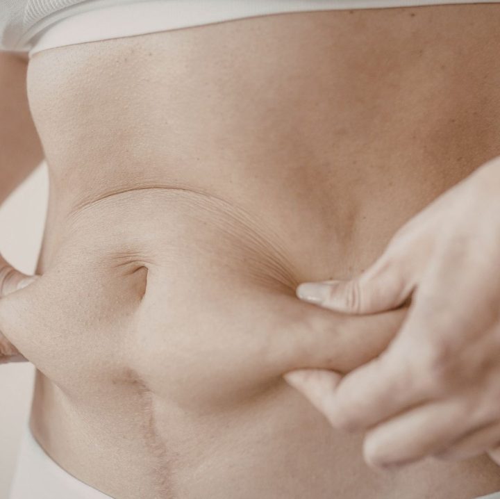 Treatment - Aventis Dental