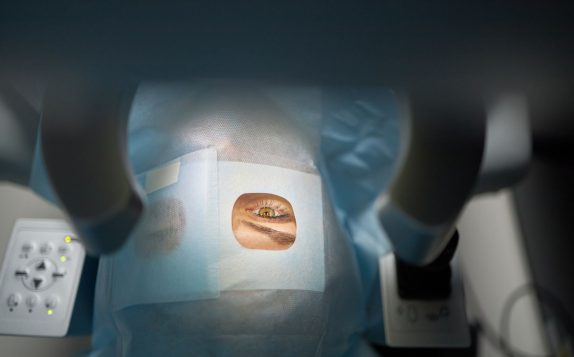 eye lid surgery