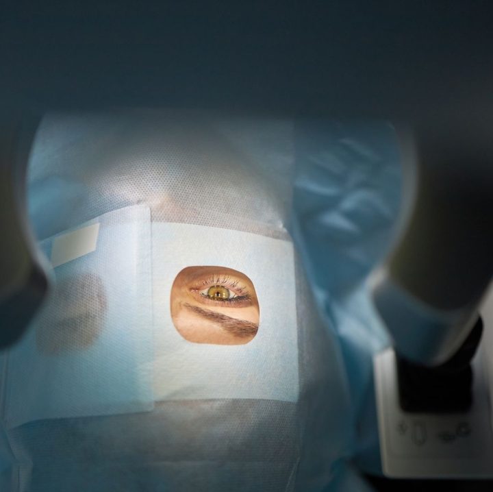 eye lid surgery