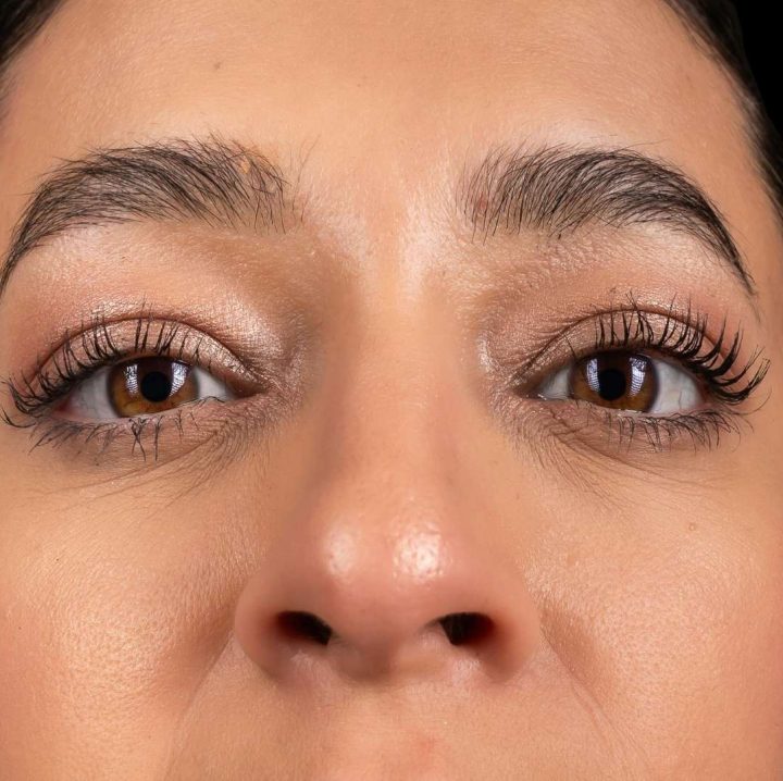 Treatment - Aventis Dental