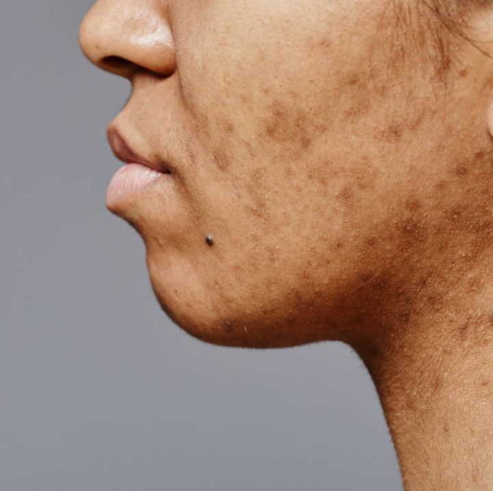 Treatment - Aventis Dental