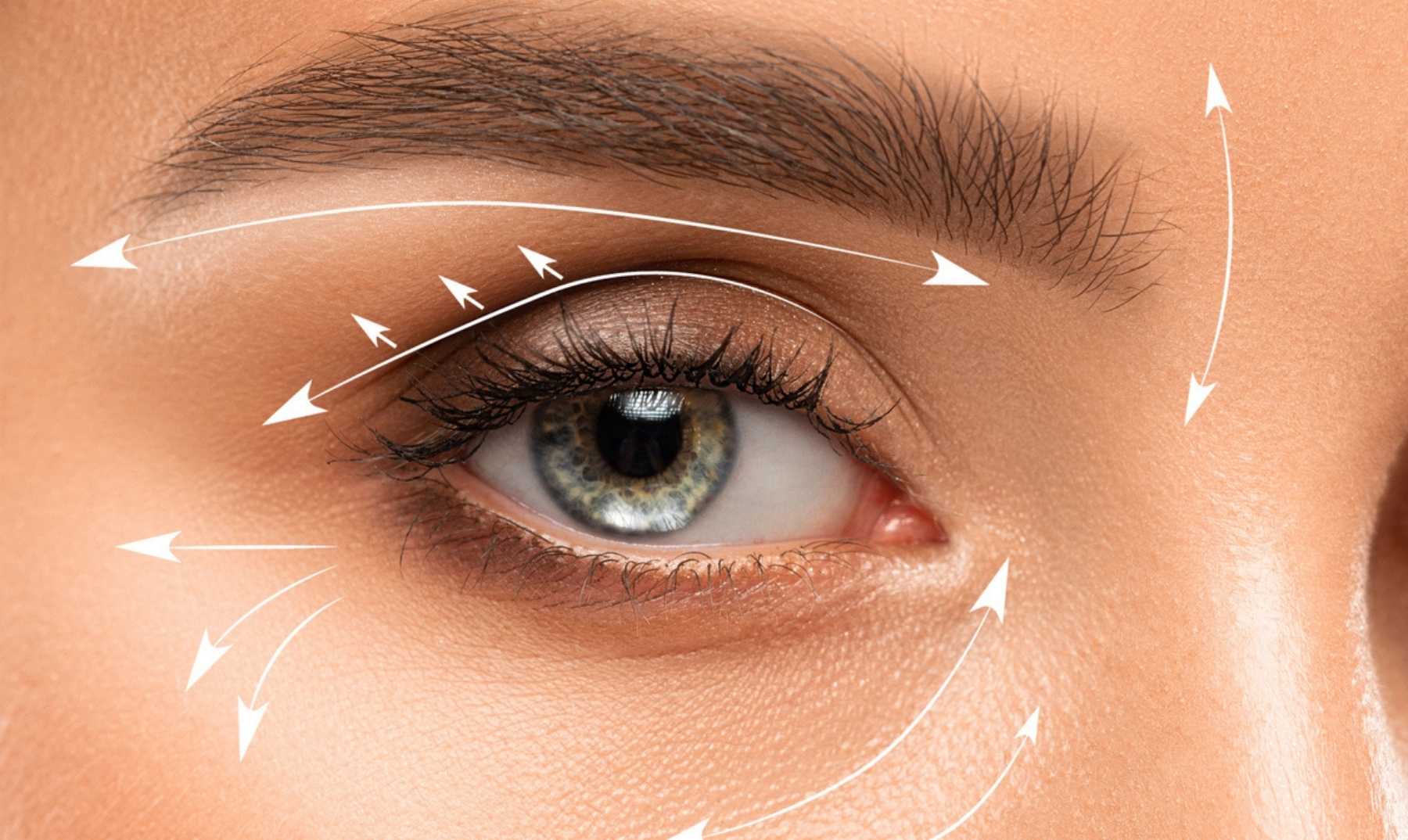 Blepharoplasty image