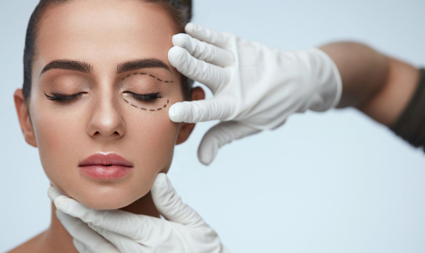 Cosmetic Eyelid Surgery