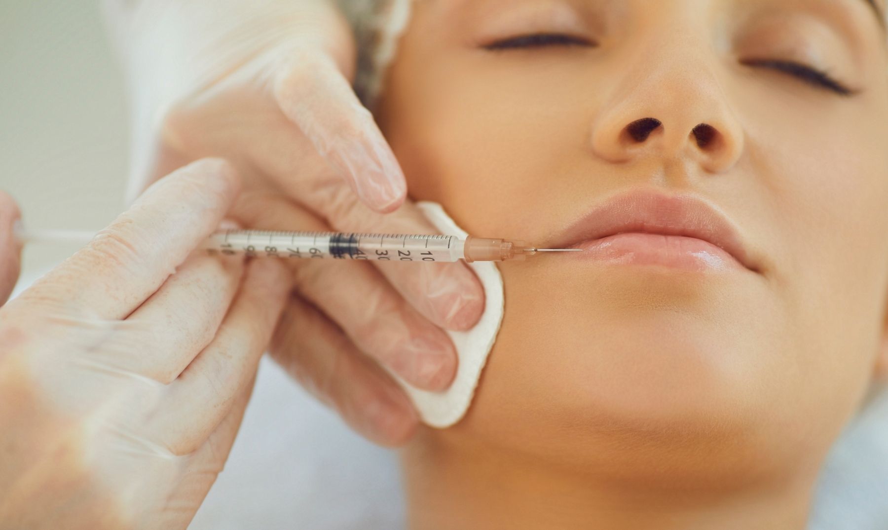 lip filler