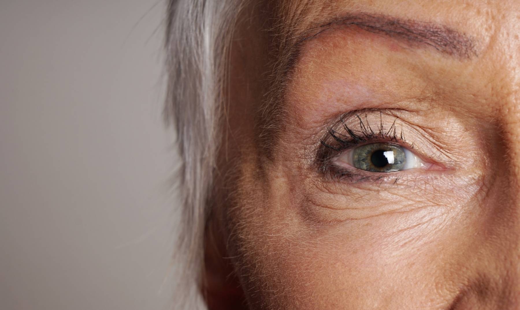 under eye bag