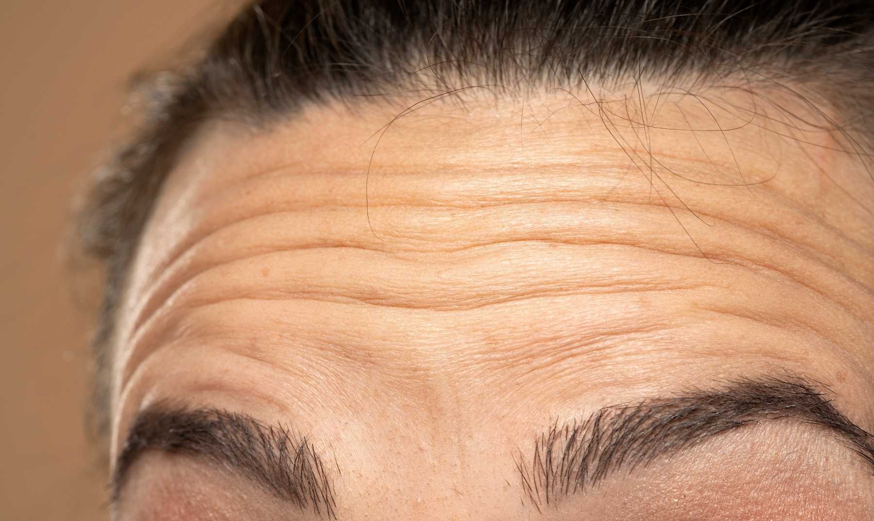wrinkles