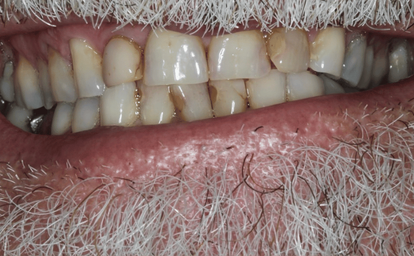 Before - Aventis dental