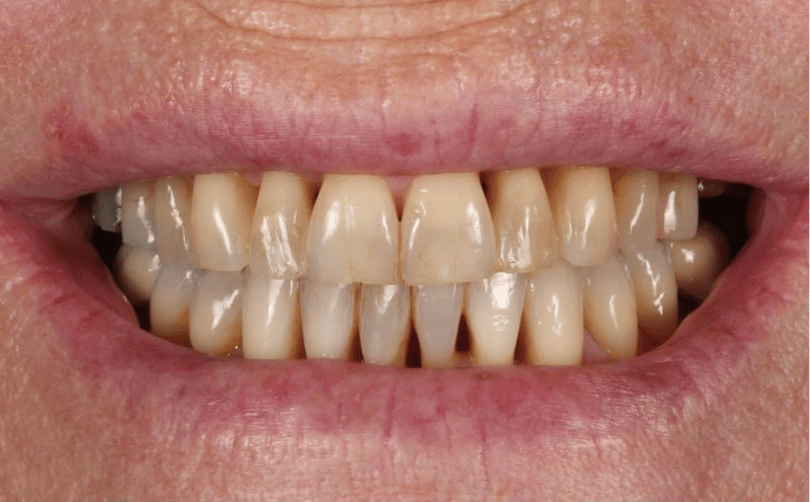 Before - Aventis dental