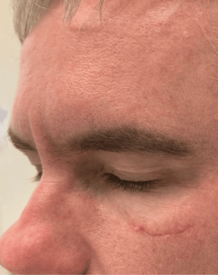 Before - Aventis dental