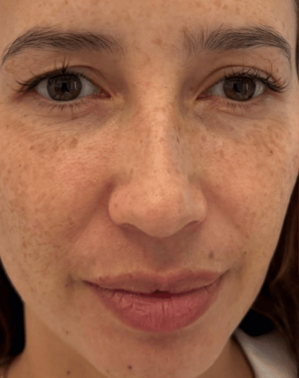 Before - Aventis dental