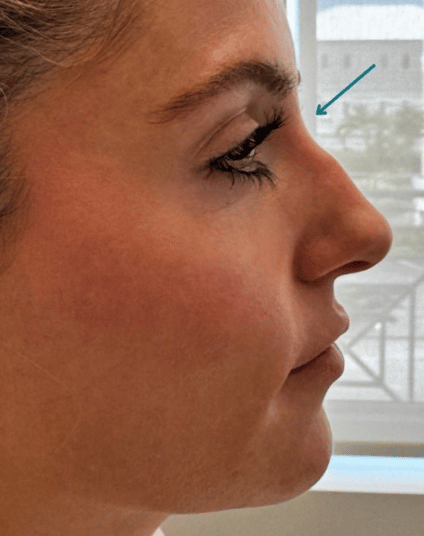 Before - Aventis dental