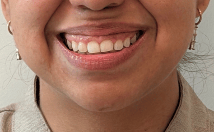 Before - Aventis dental