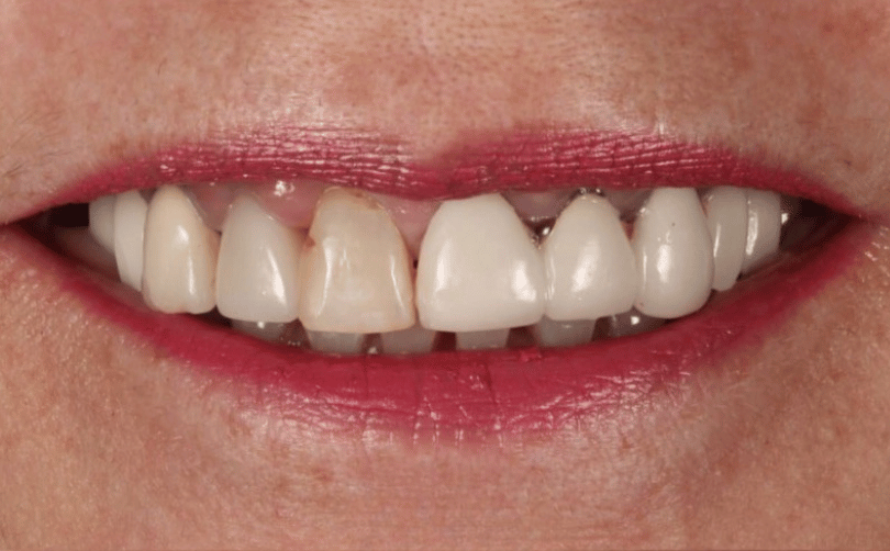 Before - Aventis dental