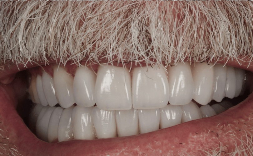 After - Aventis dental