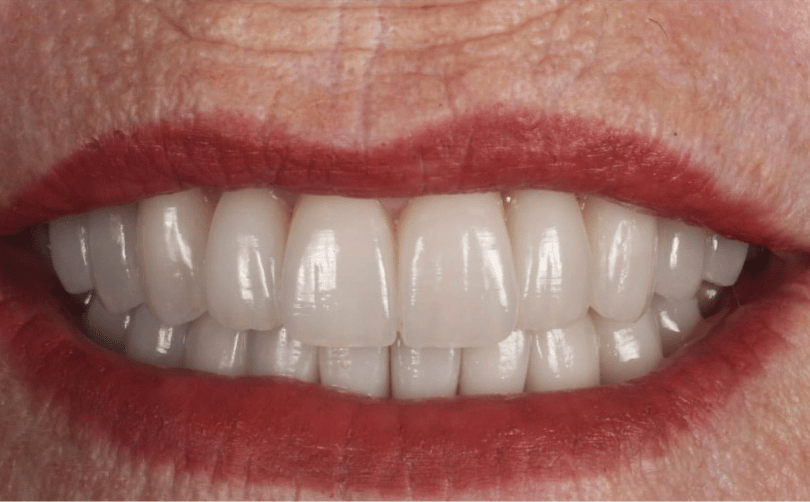 After - Aventis dental