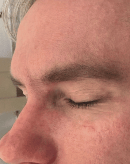 After - Aventis dental