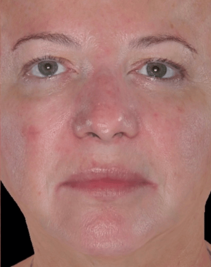 After - Aventis dental