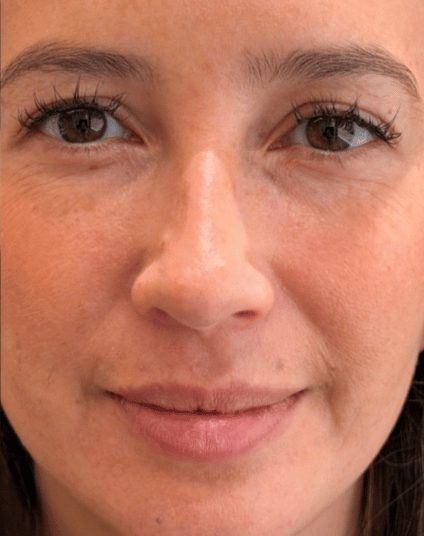 After - Aventis dental