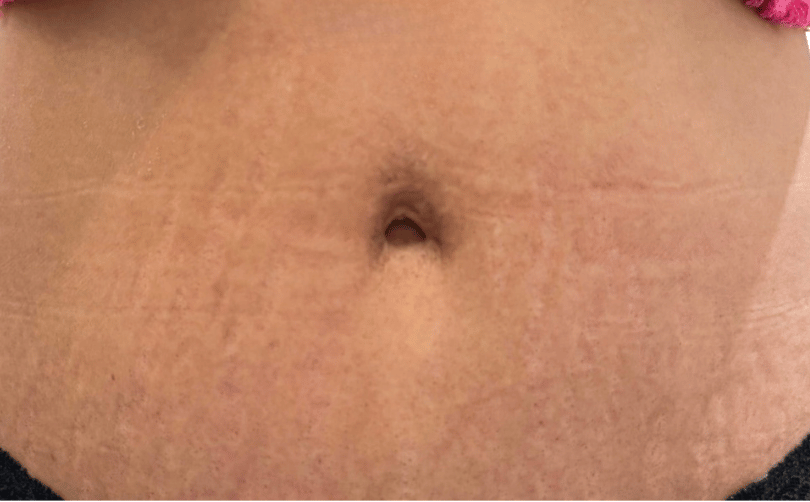 After - Aventis dental
