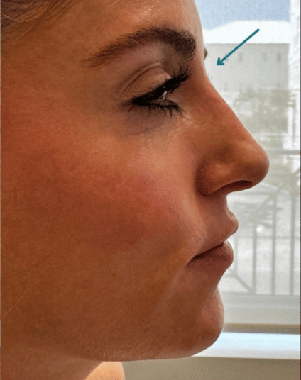 After - Aventis dental