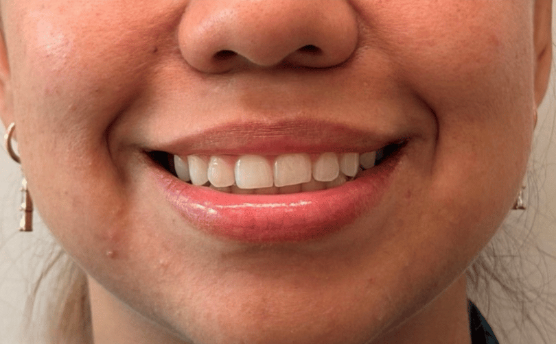 After - Aventis dental