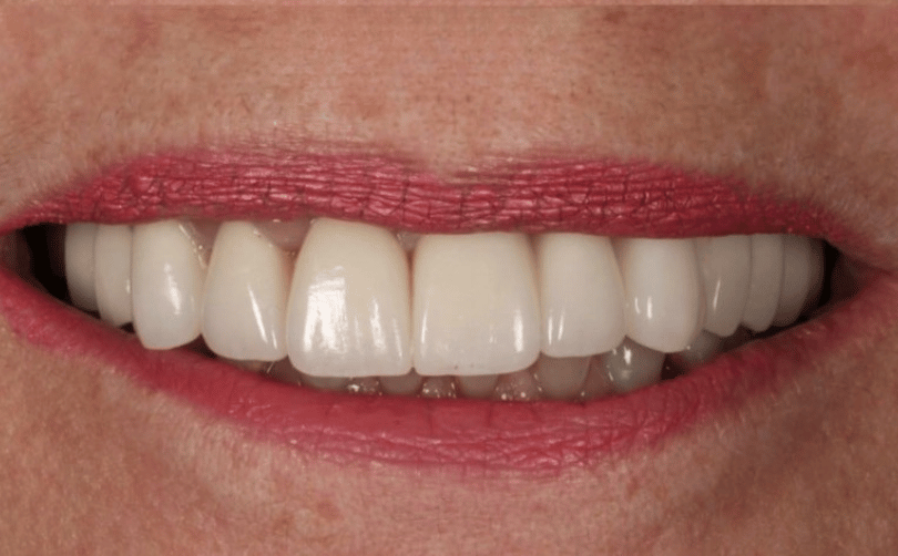 After - Aventis dental
