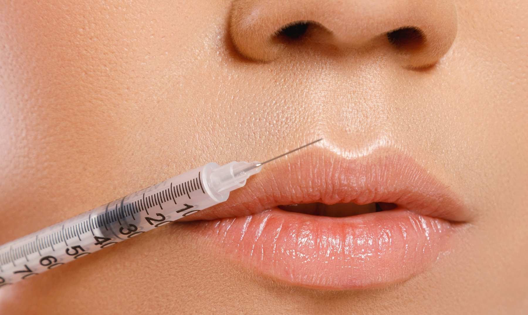 lip filler treatment
